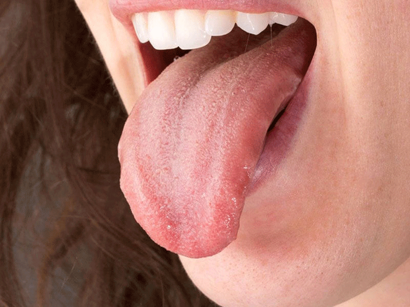 5 47