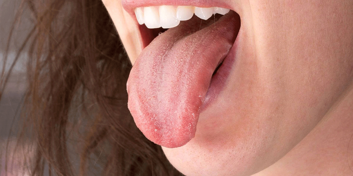 5 47