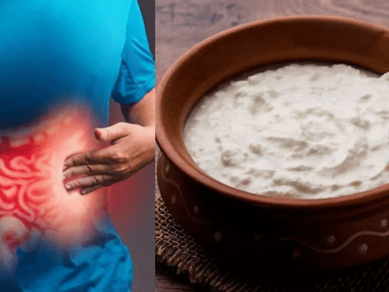കോളറെക്റ്റല്‍ കാന്‍സര്‍ ചെറുക്കാന്‍ തൈരും നാരുകളും